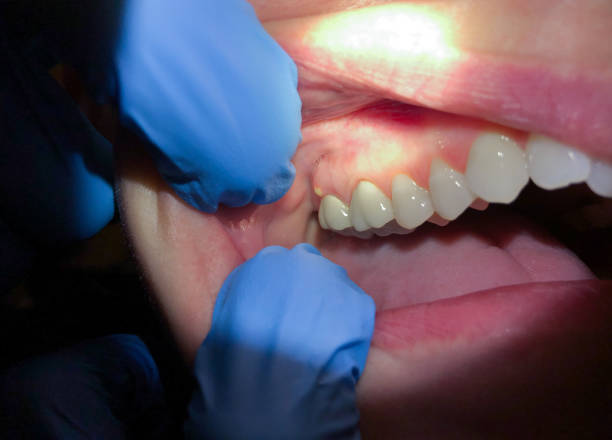 Best Weekend Emergency Dental Services in Curwensville, PA