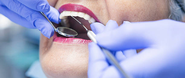 Best Emergency Cosmetic Dentistry (e.g., broken veneers) in Curwensville, PA